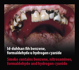 Malta 2009 Consituents - diseased organ, benzene, nitrosamines, formaldehyde, hydrogen cyanide